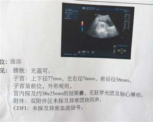 洛阳福婴国际代孕价格：头痛非小事，跟这些原因都有关