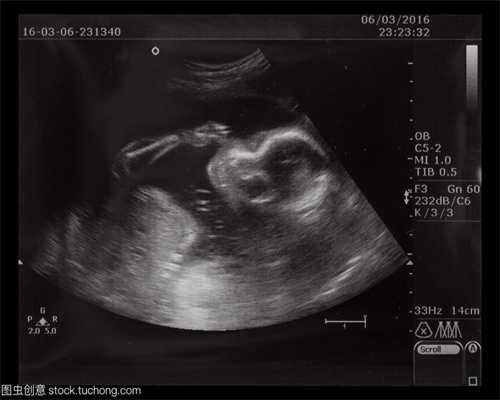 代孕操作流程：代孕七个月胎儿发育情况